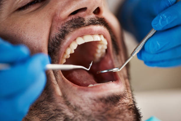 Best Emergency Cosmetic Dentistry in Oatfield, OR