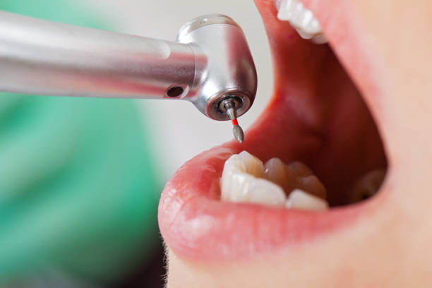 Best Orthodontic Emergency Dentist in Oatfield, OR